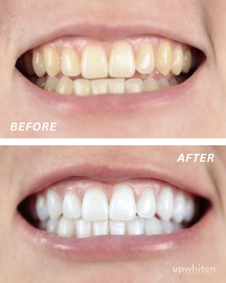 Before and after number 1, shot under the same light at every visit