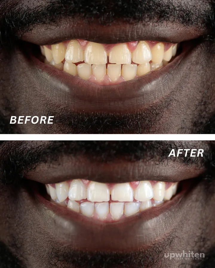 Before and after number 2, shot under the same light at every visit