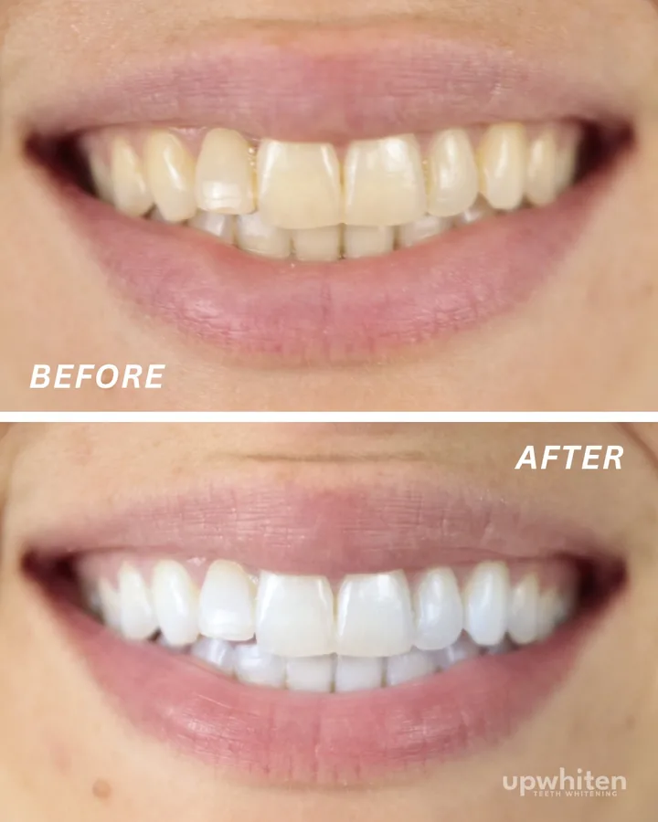 Before and after number 3, shot under the same light at every visit
