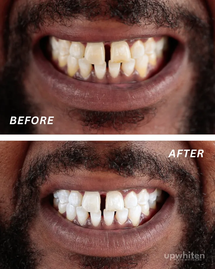 Before and after number 9, shot under the same light at every visit