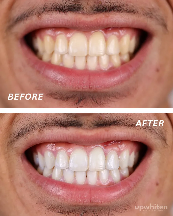 Before and after number 10, shot under the same light at every visit