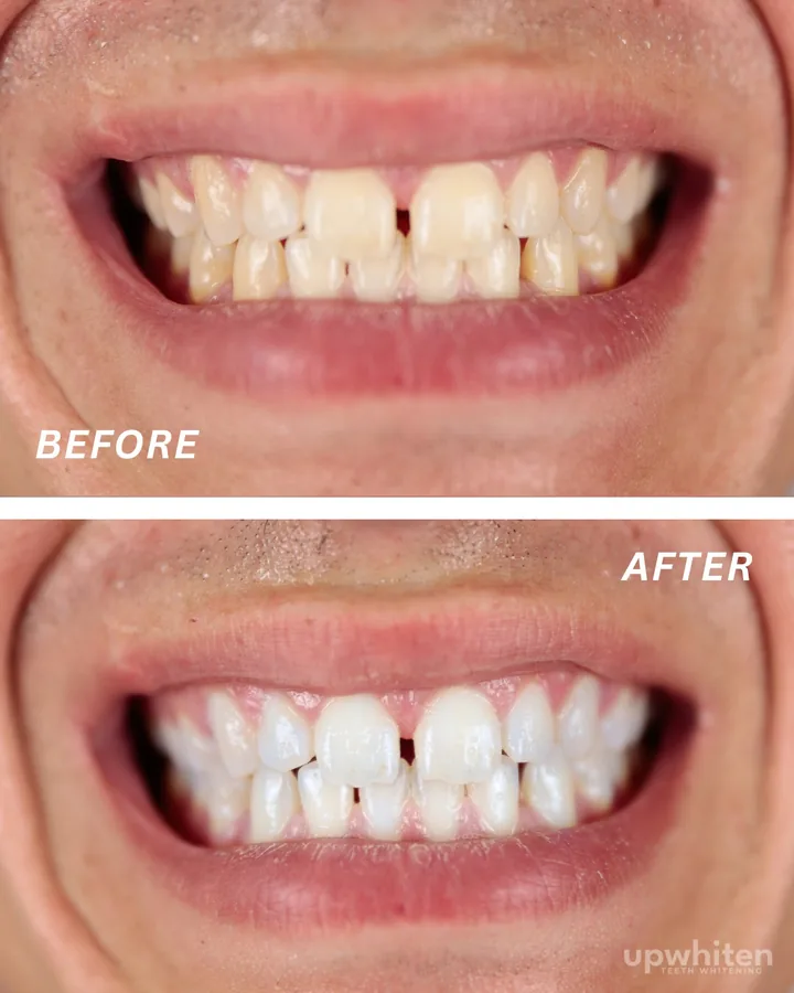 Before and after number 12, shot under the same light at every visit