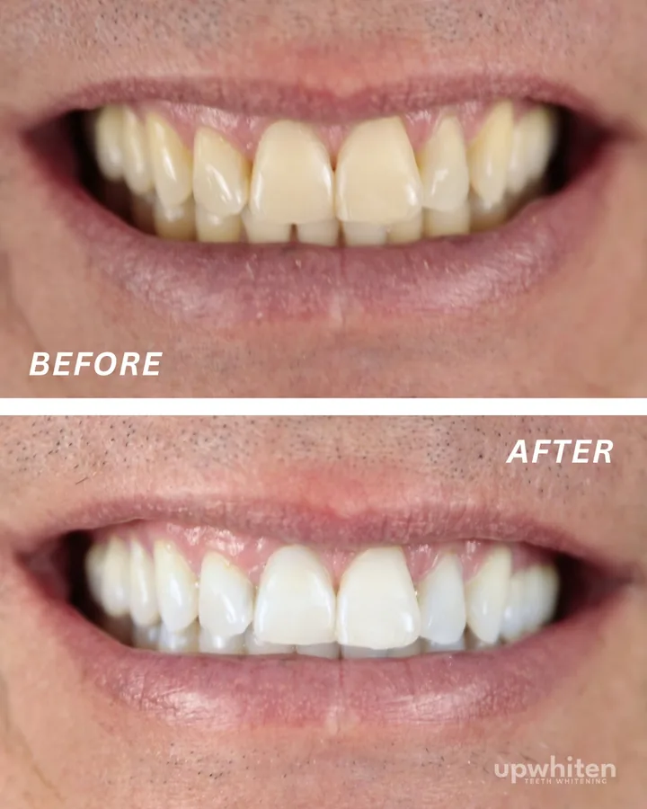 Before and after number 7, shot under the same light at every visit