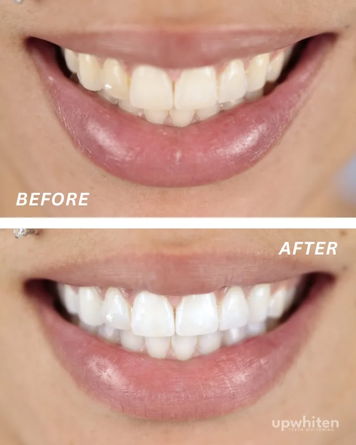 Before and after number 8, shot under the same light at every visit